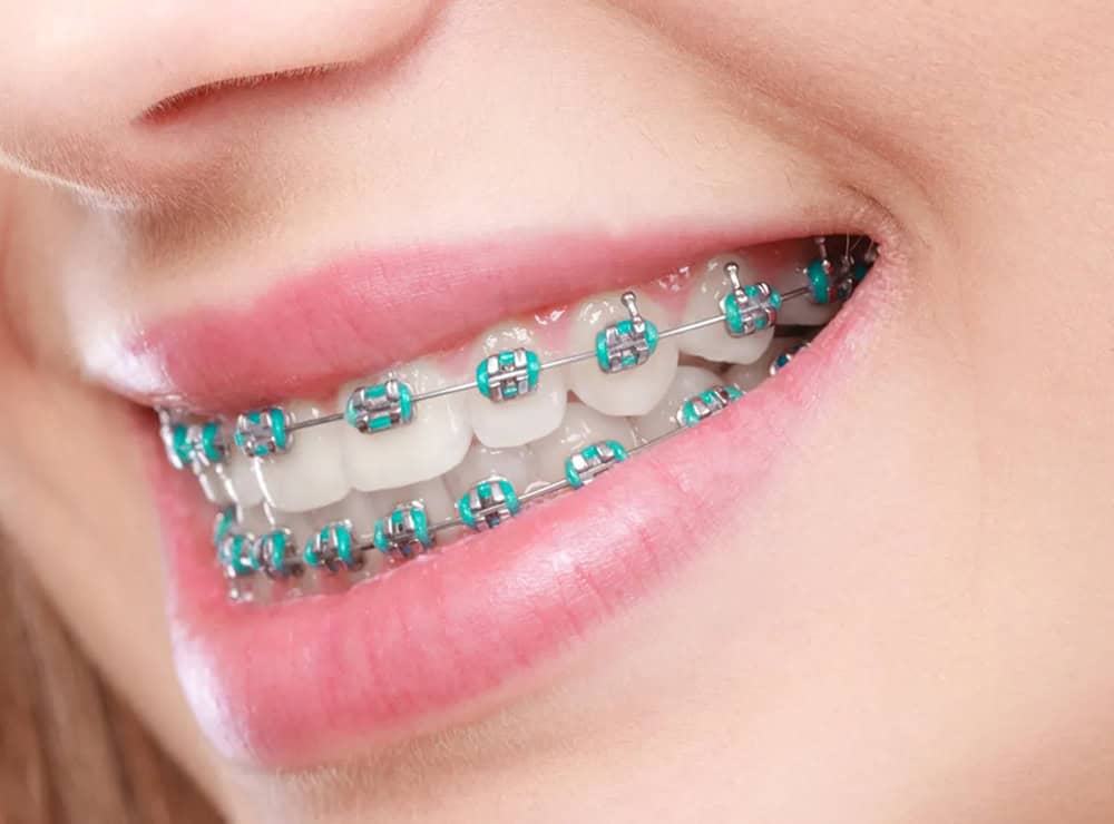 dental clinic Puchong