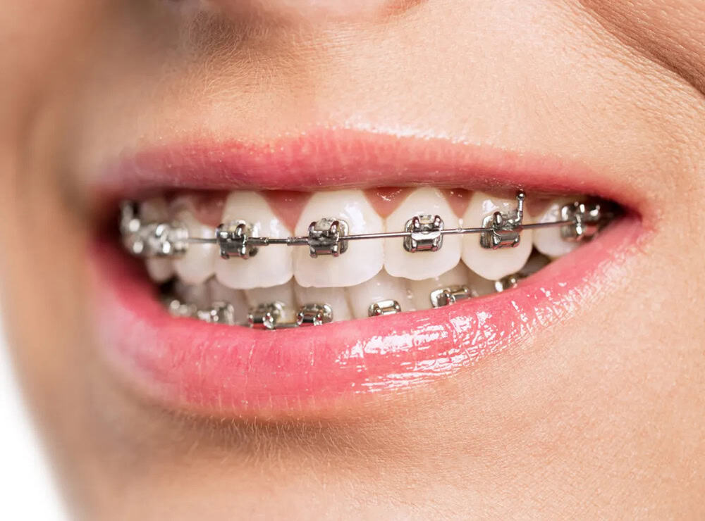dental clinic Puchong