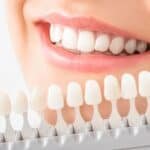 teeth whitening service Puchong