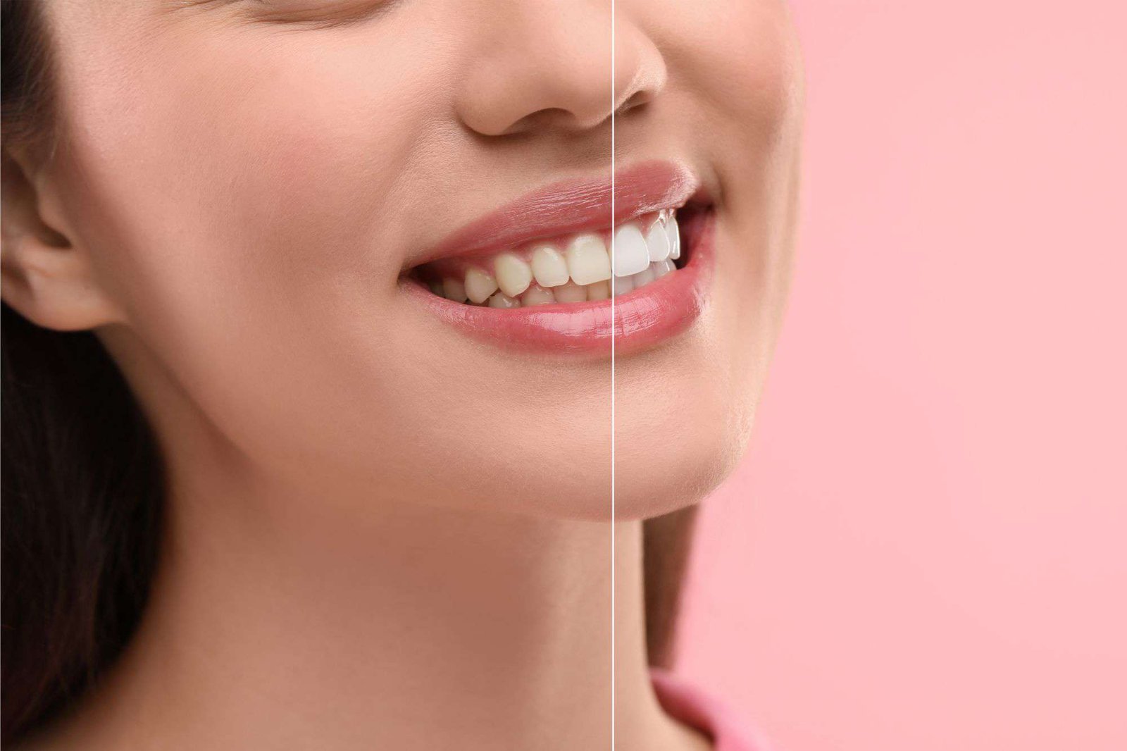 cosmetic dentistry Puchong