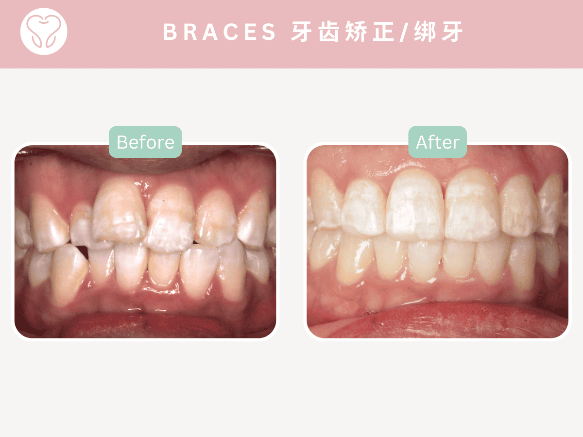 dentist Puchong