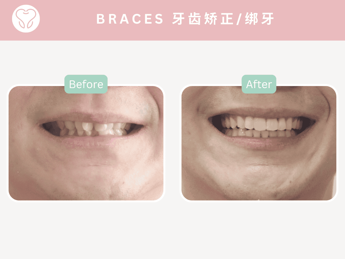 dental clinic Puchong