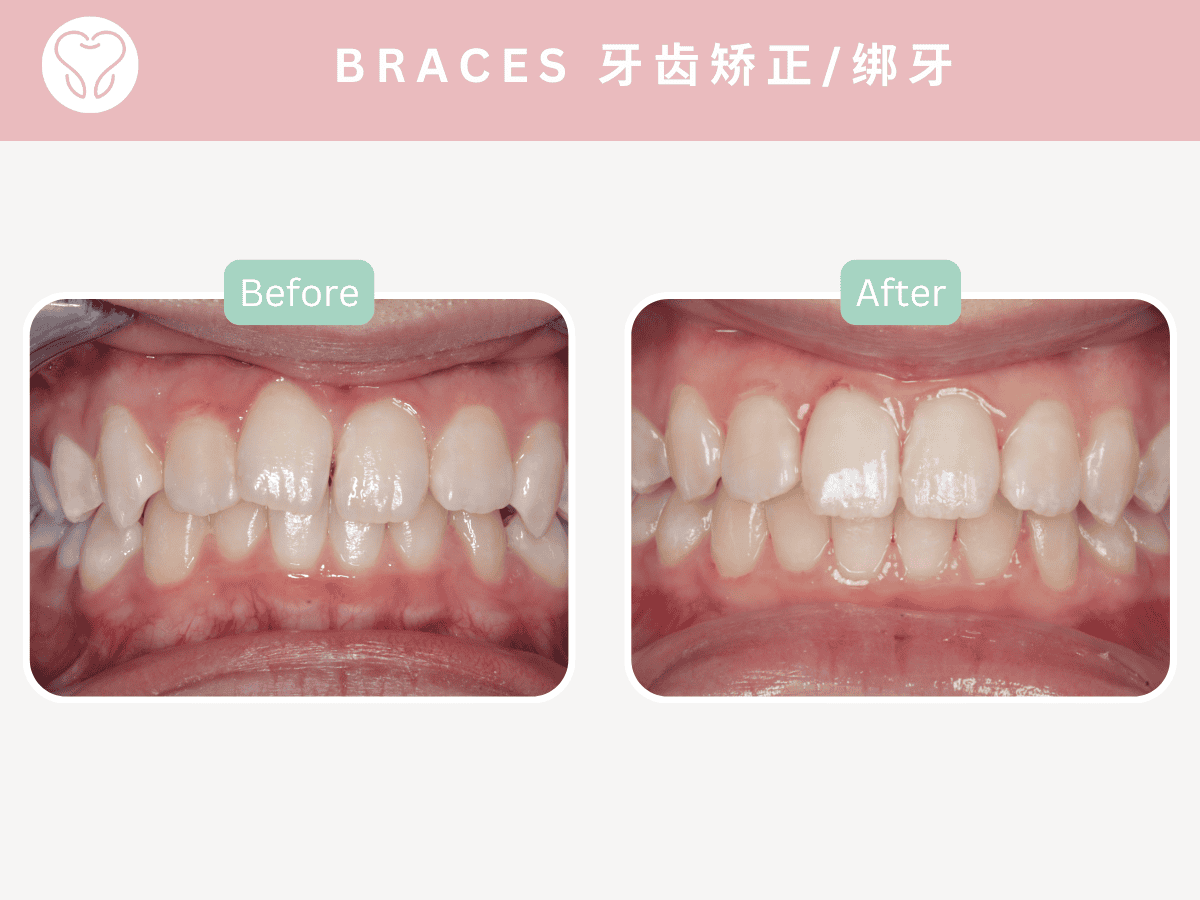 dental clinic Puchong