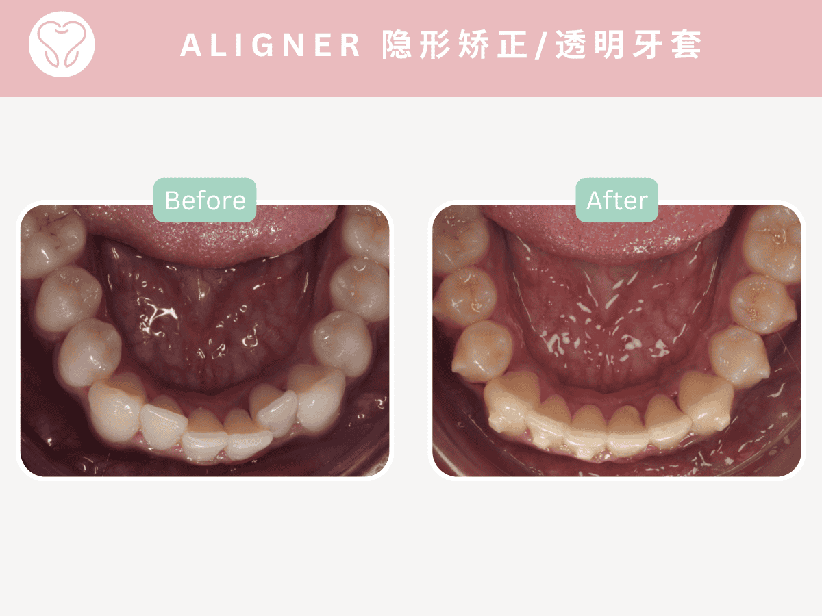 dental clinic Puchong
