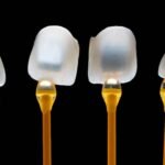 dental veneer Puchoong