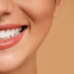 dental veneer Puchoong