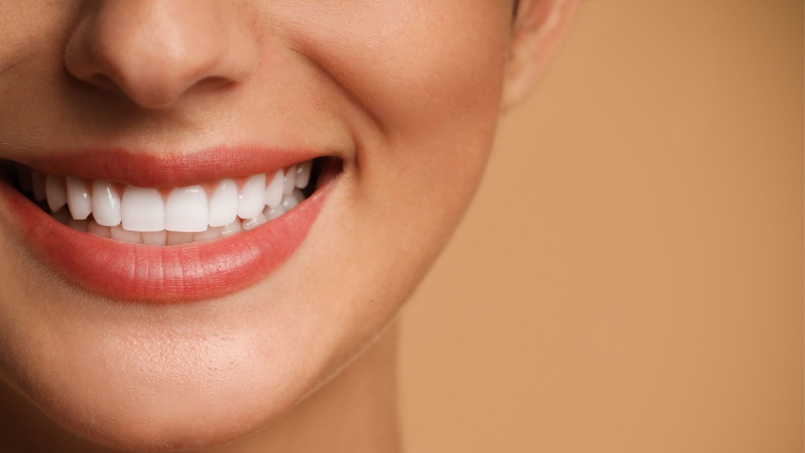 dental veneer Puchoong