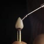 single dental implant