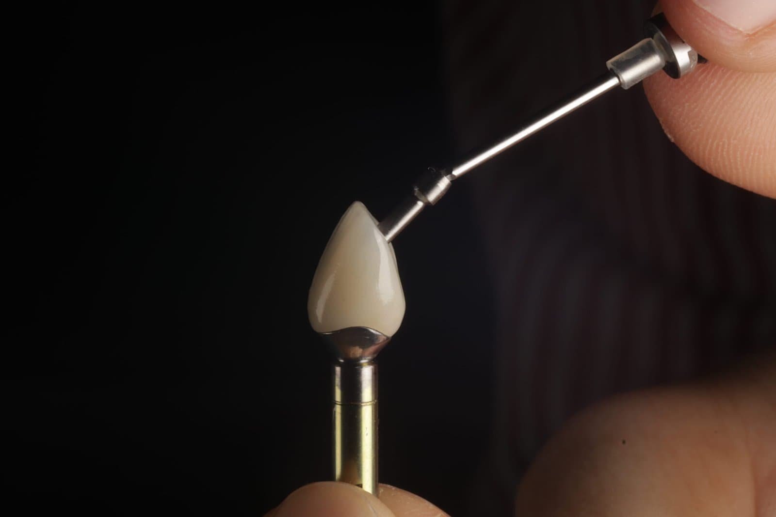 single dental implant